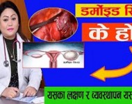 डर्मोइड सिस्ट के हो ? थाहा पाईराख्नु होस् ?