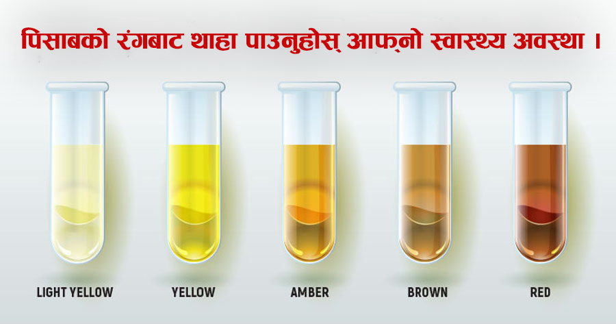 बदलिदो पिसाबको रंगले गर्छ यी रोगको संकेत 